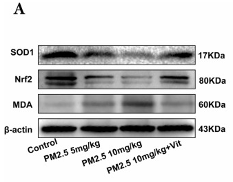 beta Actin Antibody - Fig.