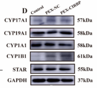 Cytochrome P450 17A1 Antibody - Figure 3.