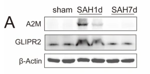 beta Actin Antibody - Fig.