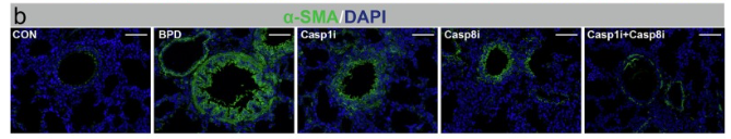alpha-SMA Antibody - Fig.