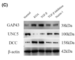 DCC Antibody - FIGURE 2 KOA synovial fibrosis initiates Netrin-1 induction of sensory nerve germination.
