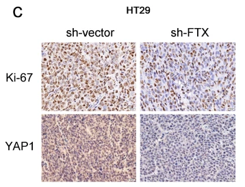 Ki67 Antibody - Fig.
