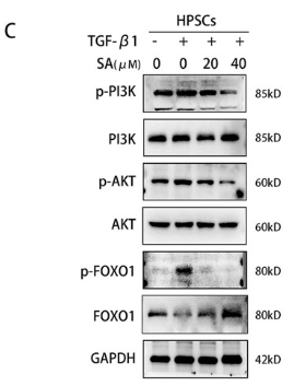Phospho-PI3K p85 alpha (Tyr607) Antibody - Figure 4.