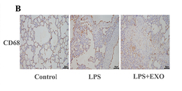 CD68 Antibody - Figure 7 RLE—6TN Cell Exosomes Induce Macrophage Polarization and Exacerbate Lung Injury in Sepsis Rats.
