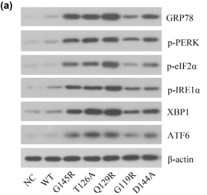 Phospho-eIF2 alpha (Ser51)[Ser52] Antibody - Figure 4 ERS-related protein expression in different SHB plasmid-transfected cells.