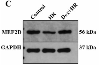 MEF2D Antibody - Fig.