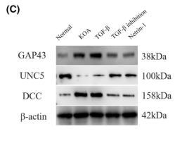UNC5B Antibody - FIGURE 2 KOA synovial fibrosis initiates Netrin-1 induction of sensory nerve germination.