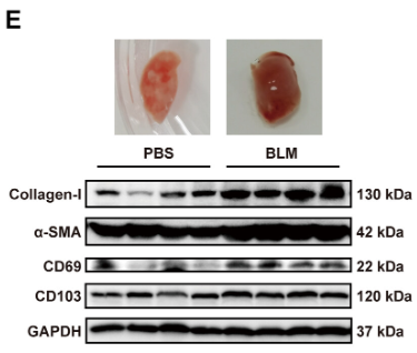 Collagen I Antibody - Figure 1.