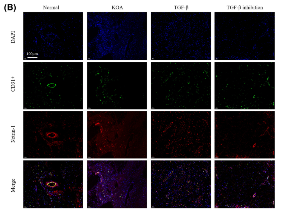 Netrin-1 Antibody - FIGURE 1 KOA synovial fibrosis activates vascular endothelial cells to promote Netrin-1 secretion.