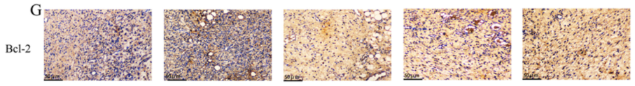 Bcl-2 Antibody - Fig.