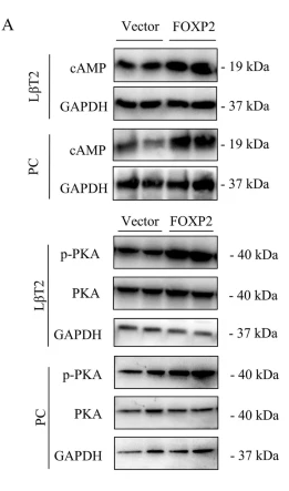 Phospho-PKA alpha/beta/gamma CAT (Thr198) Antibody - Fig.