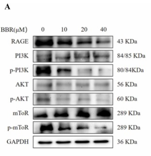 Phospho-PI3K p85 alpha (Tyr607) Antibody - Fig.