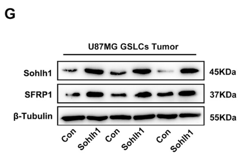 SFRP1 Antibody - FIGURE 6 Sohlh1 up-regulates the expression of SFRP1 in GSLCs.