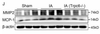 MMP2 Antibody - Fig.