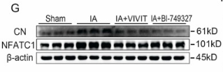 PPP3CA Antibody - Fig.