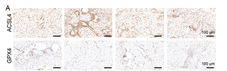 ACSL4/FACL4 Antibody - Figure 4 YS-10 ameliorates DMED by inhibiting ferroptosis.