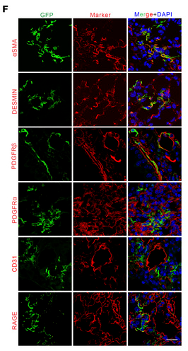 alpha-SMA Antibody - Figure 1 Postn+ cell lineage tracing during lung fibrosis.