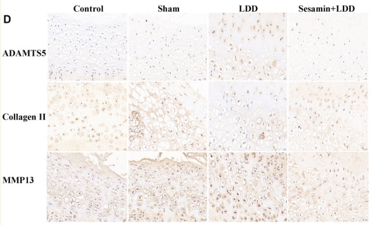 ADAMTS5 Antibody - Figure 6.