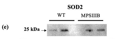 SOD2/MnSOD Antibody - Figure 3.