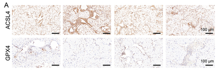 GPX4 Antibody - Figure 4 YS-10 ameliorates DMED by inhibiting ferroptosis.