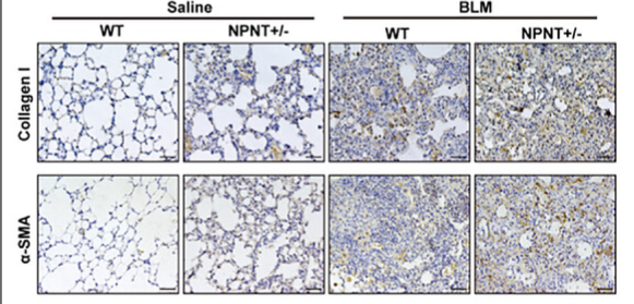 alpha-SMA Antibody - Figure 2 NPNT deficiency exacerbated BLM-induced pulmonary fibrosis and pulmonary dysfunction in mice.