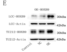 HOXB9 Antibody - Fig.