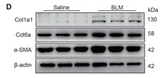 CCT6A Antibody - Figure 1CCT6A is highly expressed in lung tissues of IPF and BLM-induced lung fibrosis in mice.