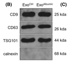 Calnexin Antibody - FIGURE 4 Uptake capacity of renal tubular epithelial cell-derived exosomal miR-664a-5p by podocytes.