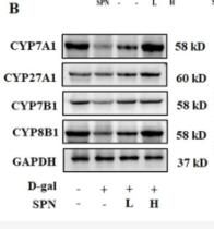 Cytochrome P450 27A1 Antibody - Figure 4.