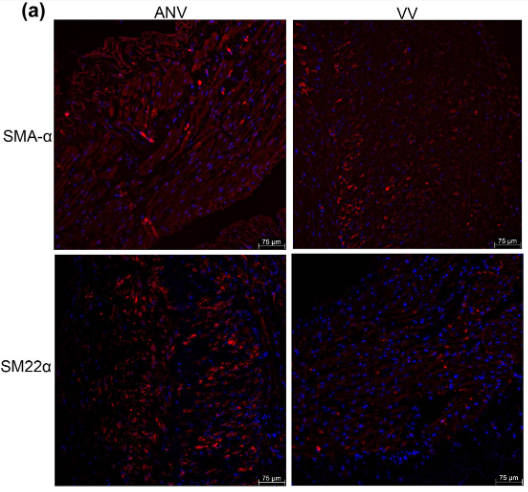 alpha-SMA Antibody - Figure 2 Expression of SMA-α and SM22α in varicose vein tissues.