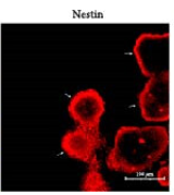 Nestin Antibody - Figure 4 (a) siRNA interferes with intracellular protein expression: (a) and (b) western blotting for protein expression of Nurr1, TH, and SHH after transfection of si-Nurr1 and si-SHH; (c) and (d) One-way ANOVA statistics of the data using SPSS; data are expressed as mean ± SEM; n ≥ 3, ( ∗P < 0.