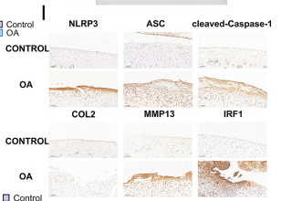 Collagen II Antibody - Fig.