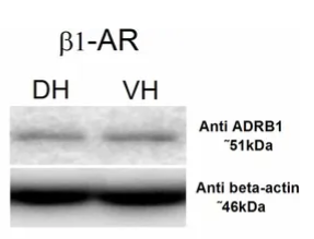 ADRB1 Antibody - Figure 4.