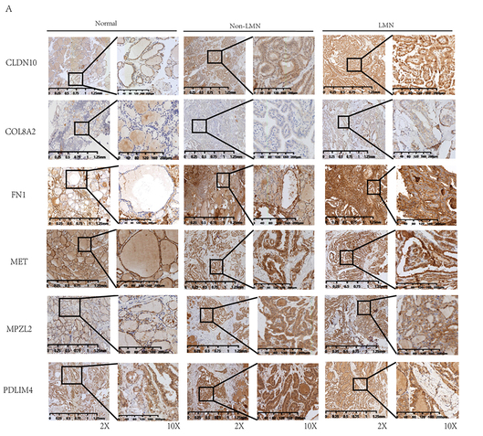 Collagen VIII  alpha 2 Antibody - Figure 8 Immunohistochemical analysis of hub genes.