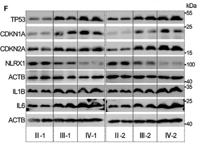 IL1 beta Antibody - Figure 1.