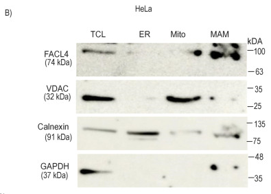 ACSL4/FACL4 Antibody - Figure S3 ORMDL3 overexpression decreases ER-mito distance and promotes NLRP3 localization to mitochondria not total NLRP3 expression.