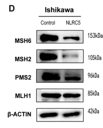 PMS2 Antibody - Figure 2 NLRC5 inhibits the expression of MMR genes in EC cells.