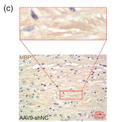 Myelin Basic Protein/MBP Antibody - FIGURE 3 Pld4 deficiency impaired remyelination in the corpus callosum.