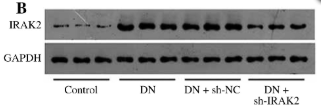 IRAK2 Antibody - Fig.