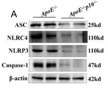 Phospho-NLRC4 (Ser533) Antibody - FIGURE 3 p16 knockout (p16−/−) ameliorates the NLRP3 inflammasome pathway.