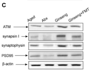Synaptophysin Antibody - Figure 3.
