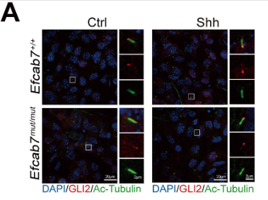Phospho-p27 Kip1 (Thr187) Antibody - Figure 4.