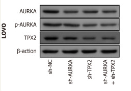 Phospho-Aurora A (Thr288) Antibody - Figure 7.