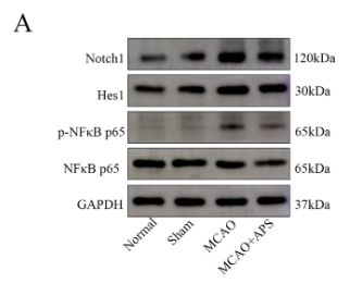 Phospho-NF-kB p65 (Ser536) Antibody - Fig.