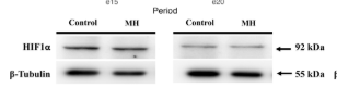 HIF1A Antibody - Figure 1.