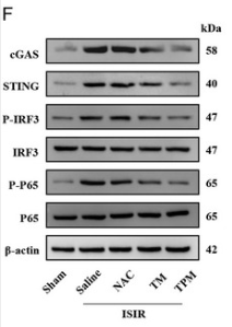 Phospho-IRF3 (Ser396) Antibody - FIGURE 4.