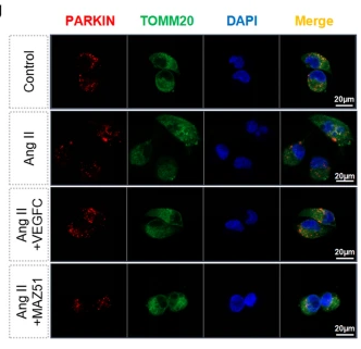 Parkin Antibody - Fig.