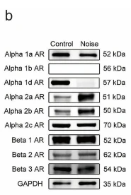 ADRB2 Antibody - Fig.