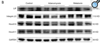 LIF Antibody - Figure 3.