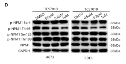 Phospho-Nucleophosmin (Thr95) Antibody - Fig.